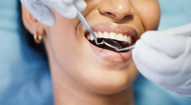 Best Emergency Dental Care for Abscessed Tooth in Arlington, TX